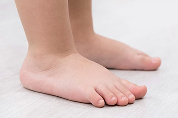 flat feet child